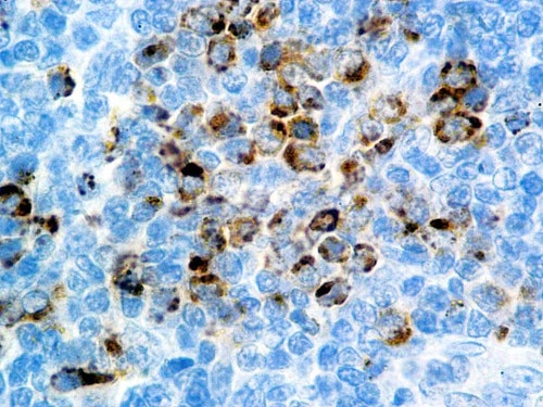 IHC of Granzyme B on a FFPE Tonsil Tissue